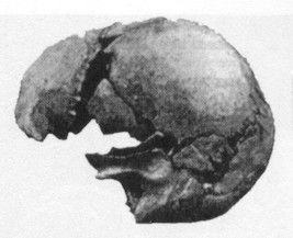 skull3.jpg (15666 bytes)